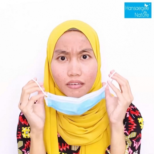 Kulit Breakout Lepas Tukar Skincare? Ini Sebabnya